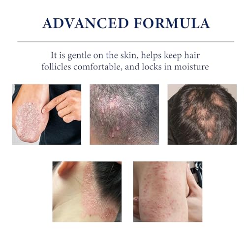 Folliculitis Care Cream for Body & Scalp - 120g