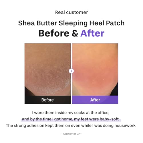 Baren Shea Butter Overnight Heel Patch - Cracked Heel Foot Mask (6 Pack)