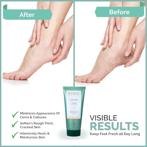 Moraz Caftan Polygonum Foot Cream for Dry Cracked Heels and Feet with 75% Polygonum Extract ? Non-greasy, Fast-absorbing Intensive Foot Moisturizer for Dry Cracked Feet, Vegan, Paraben Free, 8.5 Fl Oz