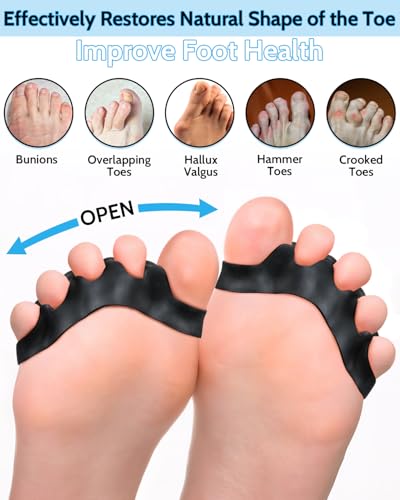 Silicone Toe Separators for Bunion Relief & Alignment - 4PCS