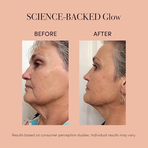 reVive Lux LED Light Therapy Wand | FDA-Cleared Acne & Anti-Aging