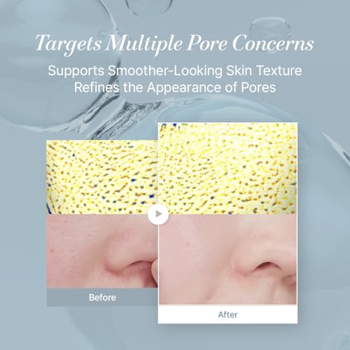starlike Niacinamide 21% Pore Serum I 1.69 Fl oz (50ml) I Korean Moisturizing & Oil Balancing Facial Serum I Soothing, Lightweight & Fresh Finish I 17 Amino Acids & Hyaluronic I Glowing Skin Care