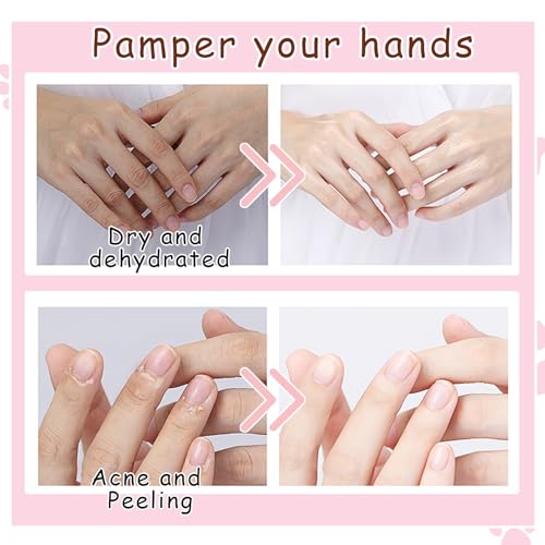 Hydrating Exfoliating Hand Mask Gloves for Dry Cracked Hands - 6 Pairs