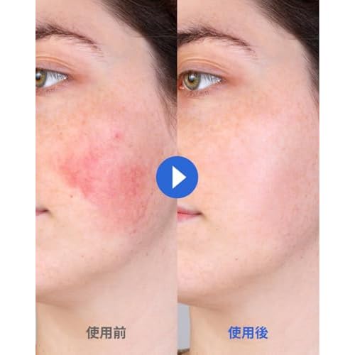 CCP Multi Stick Balm, Ultra Hydrating Korean SkinCare, Daily Moisturizing, Soothing Sensitive Dry Itchy Skin with Centella Asiatica, Ceramide & Panthenol, Skin Barrier 0.35oz