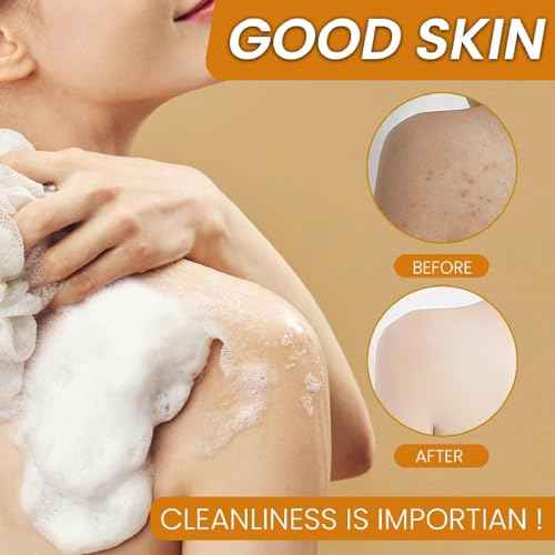 Lemon Turmeric Kojic Soap ? Kojic and Turmeric Soap, Jabon De Curcuma Para Las Manchas, TurmericSoap Bar for Face and Body, Moisturizing Deep Cleansing