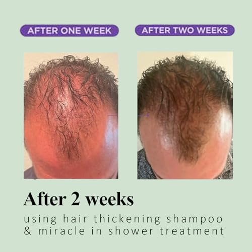 Rosemary & Biotin Shampoo for Hair Growth & Thinning
