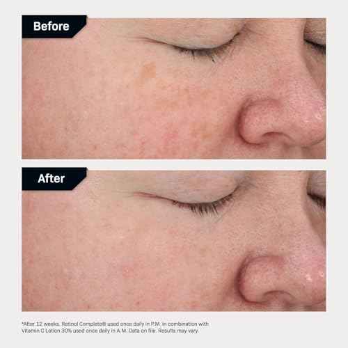 Revision Skincare Retinol Complete¢ç 0.5 Anti Aging Serum, Reduces Fine Lines and Wrinkles, Hydrating and Smoothing