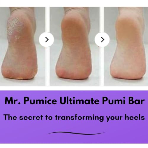 Mr. Pumice Ultimate Pumi Bar 2-in-1 Dual Grit Foot Callus Remover - 4 Pack