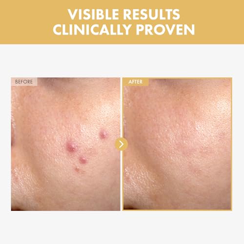 TOSOWOONG Black Snail Ginseng Serum, Ginseng 640,430ppm, Snail Mucin, Hydrating Facial Moisturizer, Acne Scar Remover, Self Care, Glow Skin Under Makeup, Korean Skin Care, 30ml, 1.01 fl. oz.