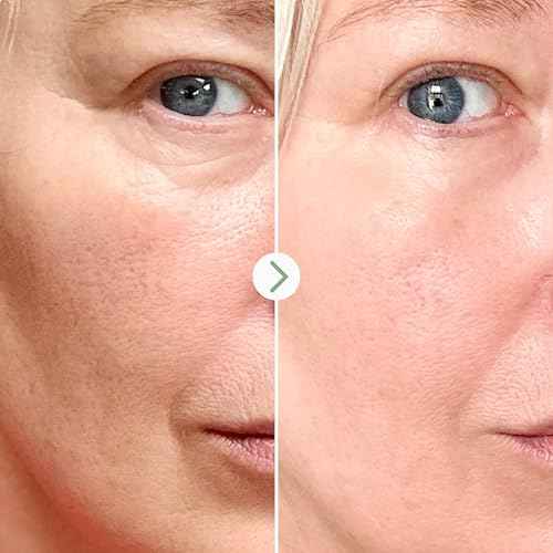 PAI SKINCARE London | BONNE NUIT BioPeptide Renewal Night Cream, Clinically Proven to Reduce Fine Lines & Boost Moisturisation by 32% Overnight. 50ml / 1.7 fl oz