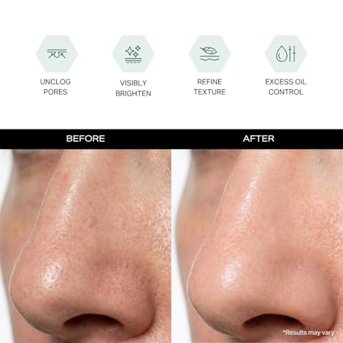 Y¡¯OUR Purifying Detox Face Mask: Blackhead, Whitehead & Pore Remover; Anti-Acne & Pimple Care; Cleansing & Exfoliating; With Salicylic Acid & Bentonite Clay. Gifts for Women