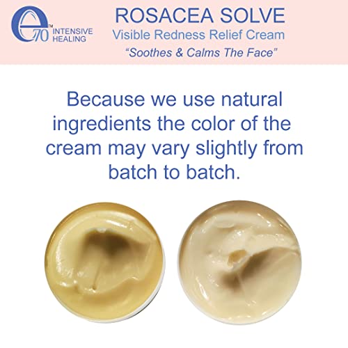 e70 Rosacea Solve - Redness Relief Cream - Face Moisturizer For Rosacea & Acne Prone Skin - Sensitive Skin Care With Organic Ingredients, Almond Oil, Licorice & Chamomile Extracts - No Parabens