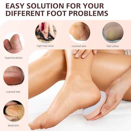BALUCA Glass Foot File Callus Remover for Feet - Nano Glass Foot Scraper Scrubber Dead Skin Removal for Cracked Heels,Professional Pedicure Tool for Home, Salon, and Travel (Apricot)