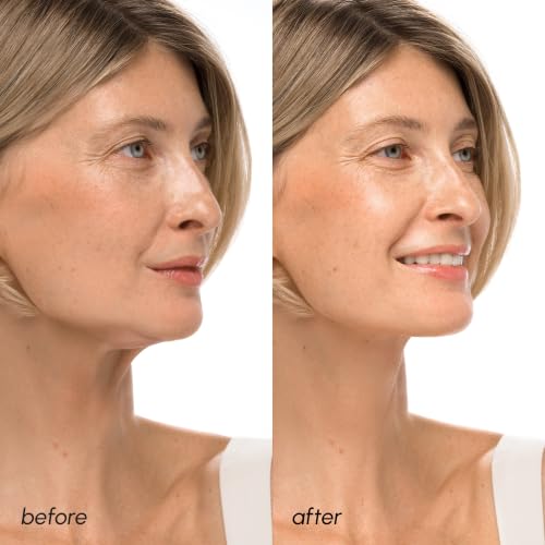 MAREE V Line Lifting Mask with Hyaluronic Acid, 5 Pack, Purple – Jawline & Neck Tightening
