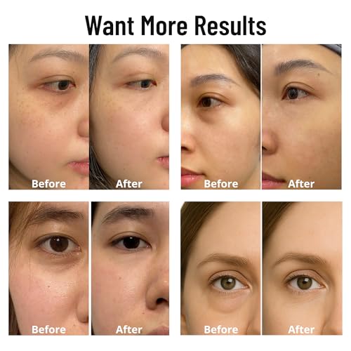 Caffeine 5% + Bakuchiol Eye Serum for Dark Circles, Puffiness Eyes with Argireline & Copper Peptides (GHK-Cu) ? Roll-on Under Eye Serum, Anti-Aging Wrinkle Care for Fine Lines? 20ml
