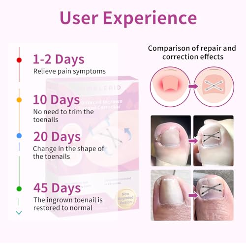 10 Patchs X-Shaped Upgrade Titanium Alloy Ingrown Toenail Corrector,At Home Ingrown Toenail Treatment for Man and Women,Ingrown Toenail Removal Kit,Curved Toenail Straightener (Small Size)