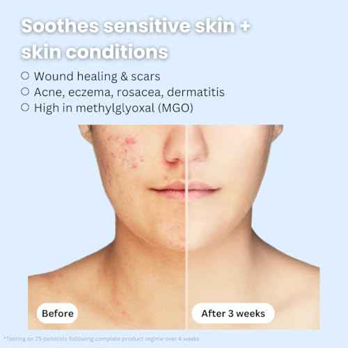 Manuka Honey 45+ MGO & Bee Venom Day Cream | 100% Natural Firming Anti-Wrinkle Face Moisturizer with Hyaluronic Acid & Vitamin C | 2oz