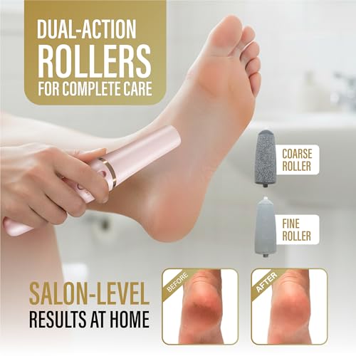 Rechargeable Electric Callus Remover for Feet with Dual Rollers - Portable Foot Care Tool