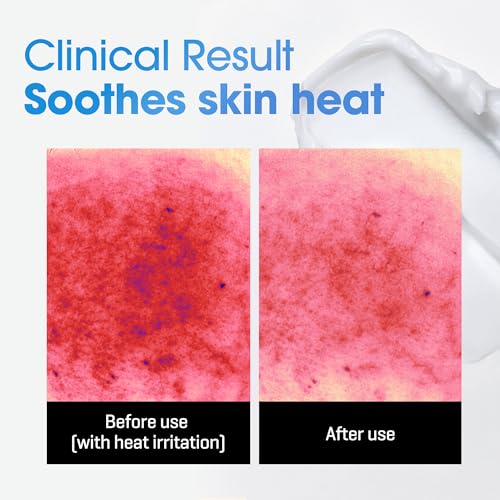 SOME BY MI Beta-Panthenol Repair Body Cream - 6.76Oz, 200ml - Hydrating and Redness-Soothing Daily Korean Panthenol Body Lotion - Rebuilds Body Skin Barrier for Sensitive Skin - Korean Skin Care