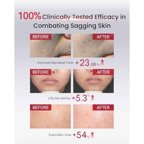 AMIRO PDRN Face Serum ? High-Potency Salmon DNA Ampoule with Nano Liposome Technology, Skin Firming & Hydrating Essence ? Must Be Used with AMIRO Microcurrent Facial Device ? 0.04 fl.oz x 30