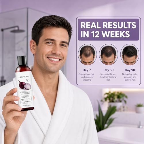 Onion Shampoo for Hair Growth - Anti Hair Loss Treatment
