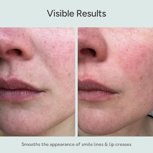 Reusable Silicone Lip Wrinkle Patches for Smile Lines