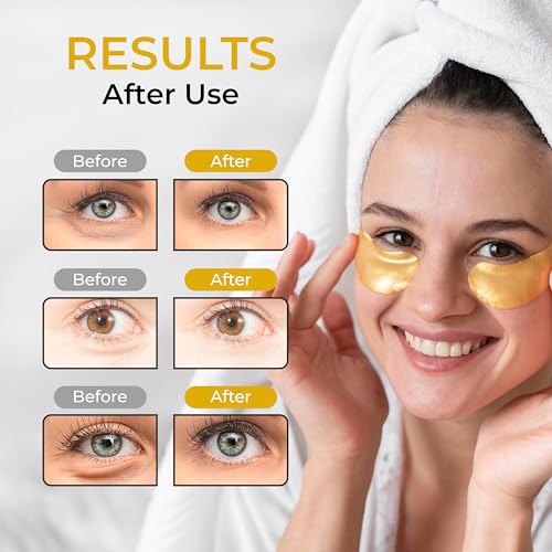 Lookix Under Eye Patches for Puffy Eyes, Dark Circles, Eye Bags - 30 Pairs