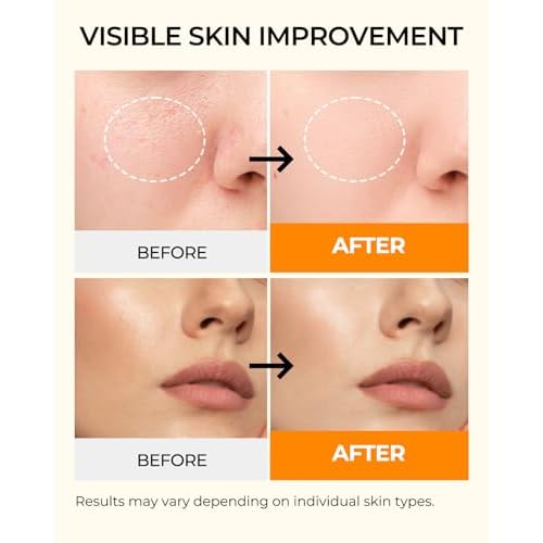 6 Sheet Masks Kojic Acid Turmeric Face Mask Even-Looking Skin Tone, Elasticity, Radiant, Hydrating Face Masks for Dull Skin Facial Mask Controlling Oil and Refining Pores Facemask Skincare