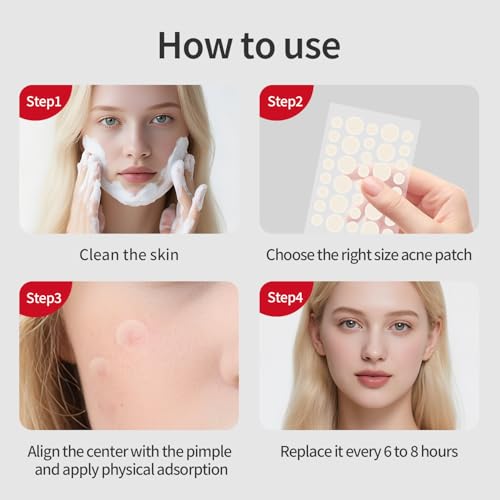 Large Pimple Patches for Facial Use, 180 Pieces in Two Sizes, Acne Hydrocolloid Patches with Salicylic Acid and Tea Tree Extract, Fast-Acting Spot Concealment, Ideal for Makeup
