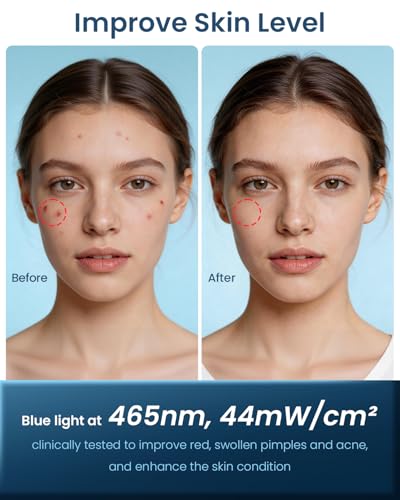Jorking FDA-Cleared Red Light Therapy Mask for Face Anti-Aging