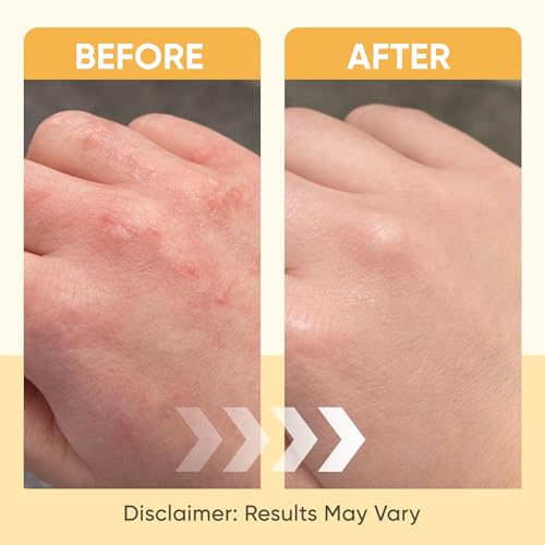 Beezema Medical Grade Honey, with Manuka Honey, Colloidal Oatmeal & Natural Oils, Natural Lotion, for Relieving Dry Skin on Hands and Body. Fast-Absorbing & Non-Greasy, Unscented - 4oz (1)