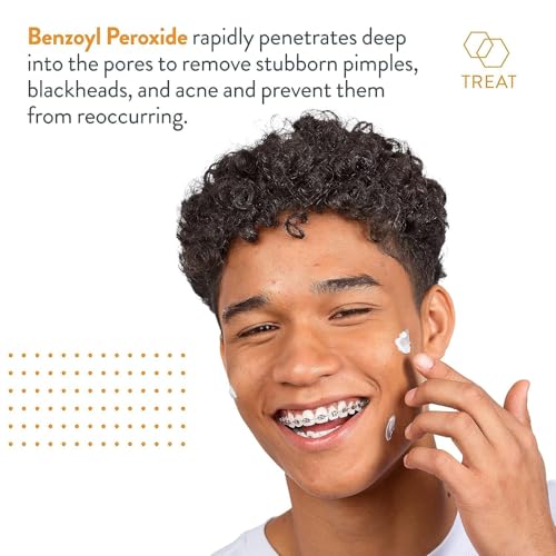 AcneFree Terminator 10 Benzoyl Peroxide Acne Spot Treatment 1oz