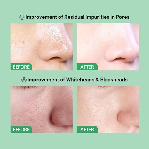 Green Tomato Clay Mask - Sebum Control & Pore Cleanser (2 Pack)
