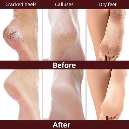 Milk Foot Masks Set - 5 Pack Hydrating Socks for Dry, Cracked Feet