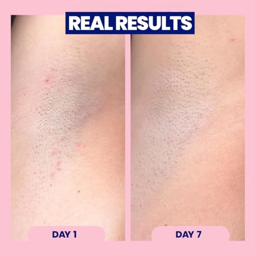 Megababe Mini Apr?s Shave (1.7 fl oz) | Travel size post-Shave & Waxing | Ingrown Hair & Razor Bump Roll-On Treatment for Women | Bikini, Armpits & Legs