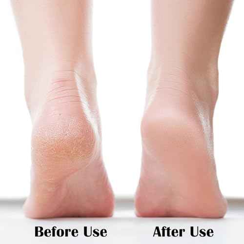 Nano Foot File, Foot Scrubber Callus Remover, Foot Care Pedicure Tool, Foot File with Nano-Level Grinding Points, Portable Foot Scrubber for Dead Skin Removal, Cracking, Wet and Dry Feet