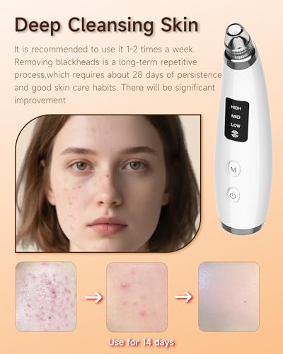 Blackhead Remover Vacuum Pore Cleaner with 6 Probes