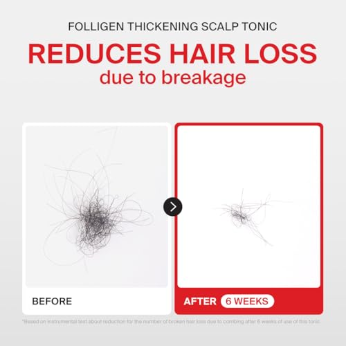 Dr.FORHAIR Folligen Tonic Scalp Serum 4.06 fl oz