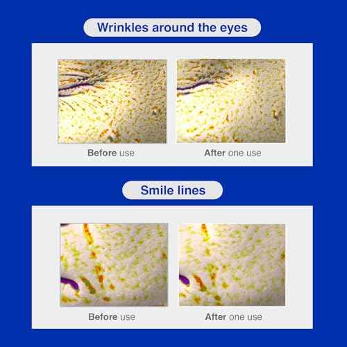 IOPE Retinol Serum in Deep Collagen Gel Mask 5+1 Set | Double-Layered Hydrogel Sheet for High Adhesion, A Full Bottle of Retinol RX 1% Serum, Intense Firming & Plumping, Anti-Aging, Korean Skincare