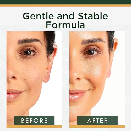 Tree of Life Vitamin C Serum for Face | Dark Spots & Fine Lines