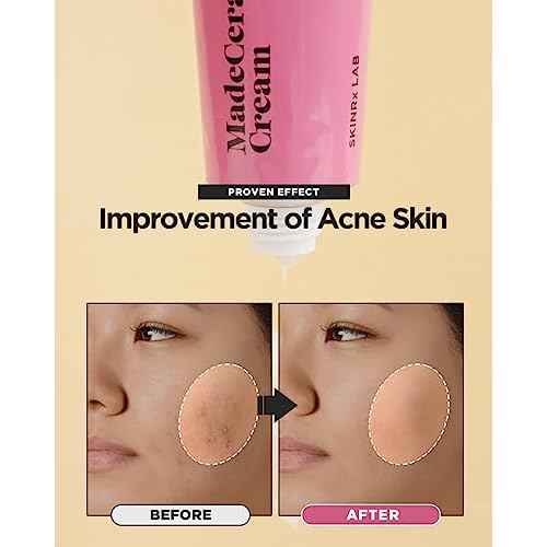 SKINRxLAB Made Cera Cream - Acne & Redness Relief Face Moisturizer, Sebum Control, Improving Skin Barrier with Ceramide and Madecassoside, Anti-Aging and Pore Minimizing Face Cream, 0.5 fl.oz.