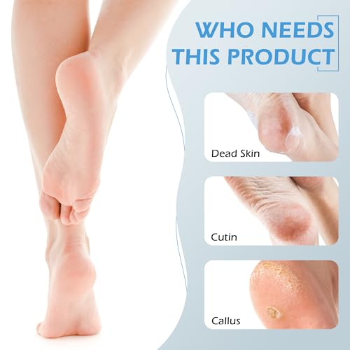 4-in-1 Foot Scrubber Brush & Callus Remover - Pumice Stone Set (3 Pack)