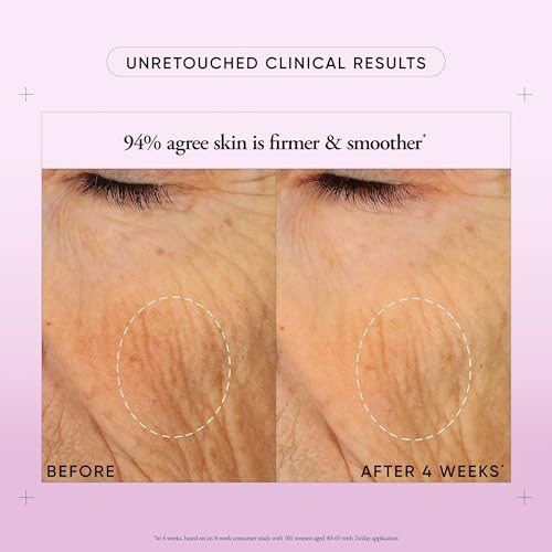 philosophy ultimate miracle worker nourish & rejuvenate face & neck cream - with patented retinol, ceramides & pro-collagen peptides - smoothes fine lines & wrinkles - fast absorbing moisturizer