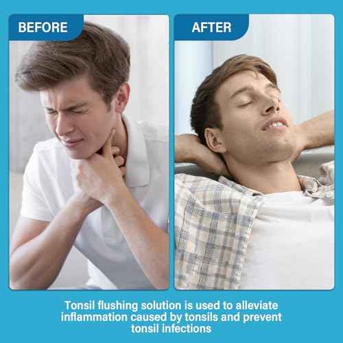 Tonsil Stone Remover, Natural Ingredients Mouthwash or Oral Rinse Liquid to Help Soothe Tonsils, Effectively Soothe Dry Mouth & Freshens Breath Tonsil Stone Mouthwash-Mint