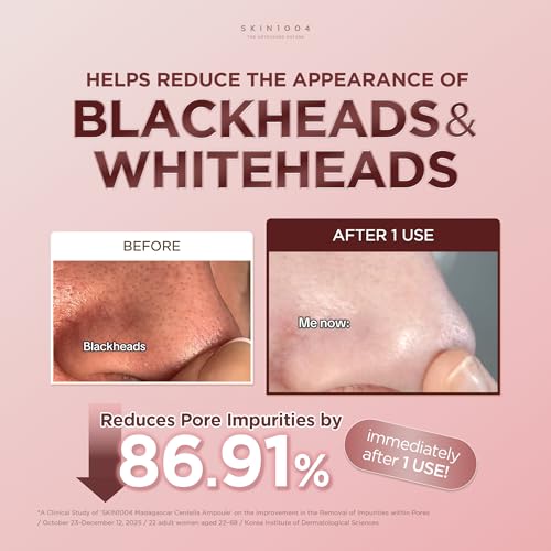 SKIN1004 Poremizing Clay Stick Mask - Pore Minimizing & Oil Control