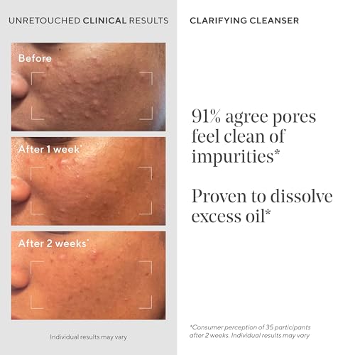 Murad Acne Control Clarifying Cleanser ? Salicylic Acid & Green Tea Formula for Acne, Deep Pore Cleansing, Oil Control & Breakout Prevention for Clear, Balanced, Healthy-Looking Skin