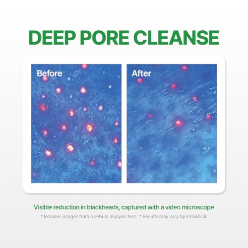 MAKE P:REM Safe Me Relief Moisture Cleansing Oil 7.1 fl oz - Gentle Deep Cleansing with Natural BHA