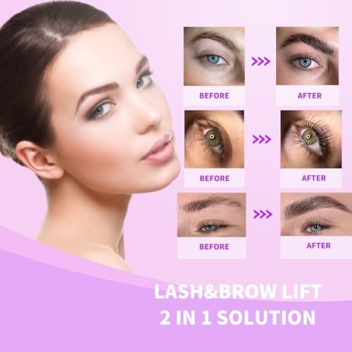 Lash Lift & Brow Lamination Kit – 6-8 Week Results