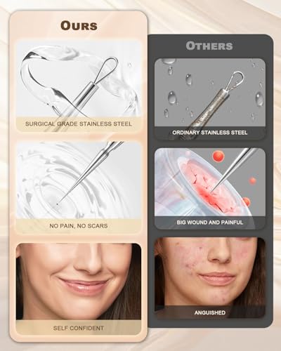Professional Facial Milia & Blackhead Removal Tool Kit