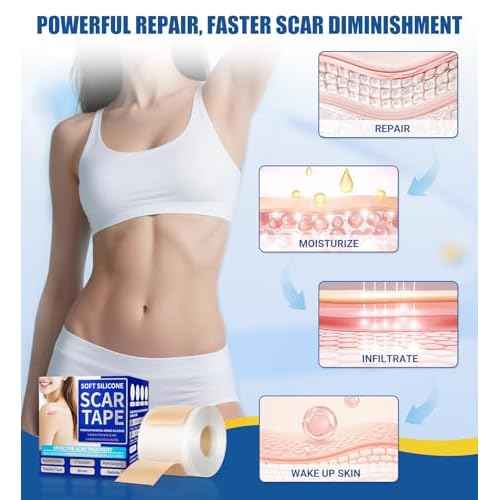 Medical Grade Silicone Scar Sheets & Tape - 1.6¡±x60" Roll, Ultra Soft, Hypoallergenic Rolls for Surgical, Keloid Scars, Tummy Tuck, C-Section, Stretch Marks, Burn & Bumps Scar Removal, 24H Comfortable